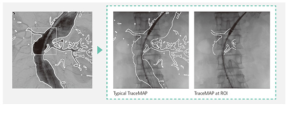 TraceMAP(SCORE MAP)