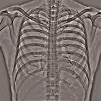 Bone Image