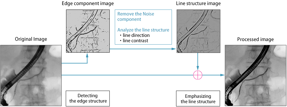 Line Detected Edge Enhancement