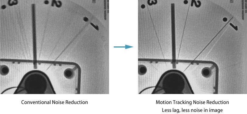 Motion Tracking Noise Reduction