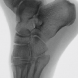 Streamline procedures