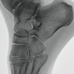 Streamline procedures