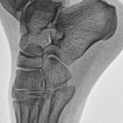 Streamline procedures