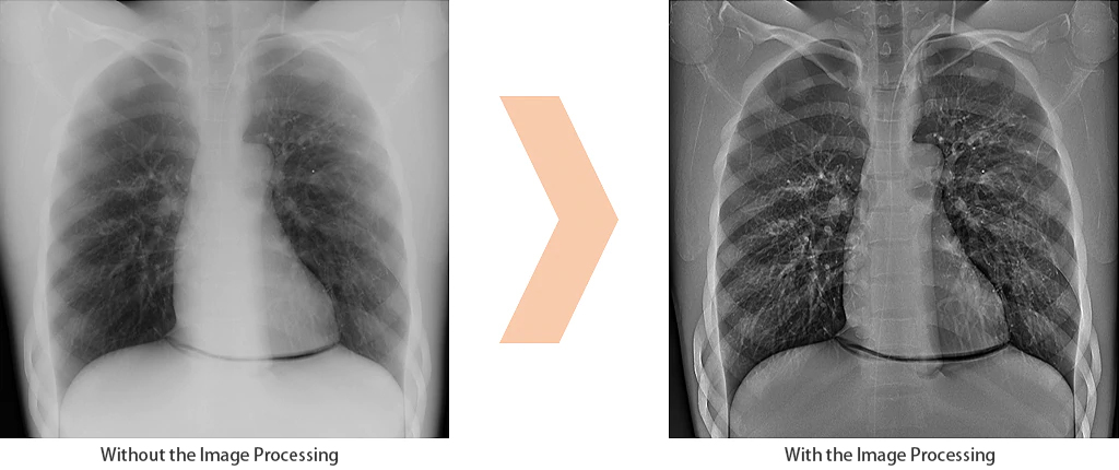 Edge Enhancement for Safer Procedures