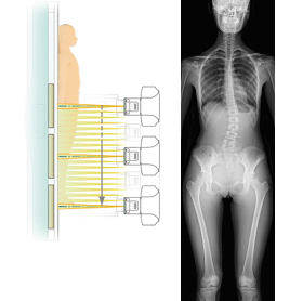 Slot Radiography（Premium option）