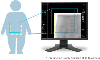 Smart FOV (Field of View)