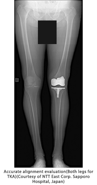 Slot Radiography on a fluoroscopy system