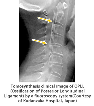 Tomosynthesis on a fluoroscopy system